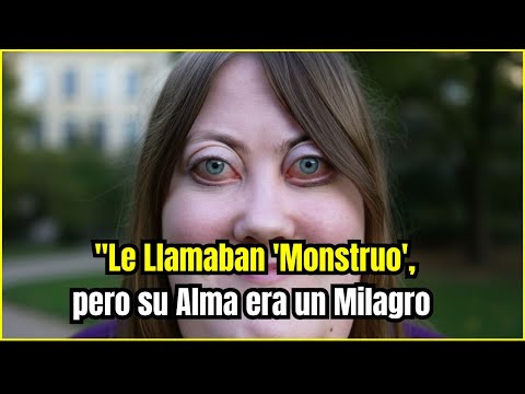 El Diagnóstico que Deformó su Rostro, pero no su Espíritu | Esta Historia te Dejará Sin Palabras